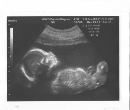 22 неделя беременности фото плода и ощущения — евромедклиник 24