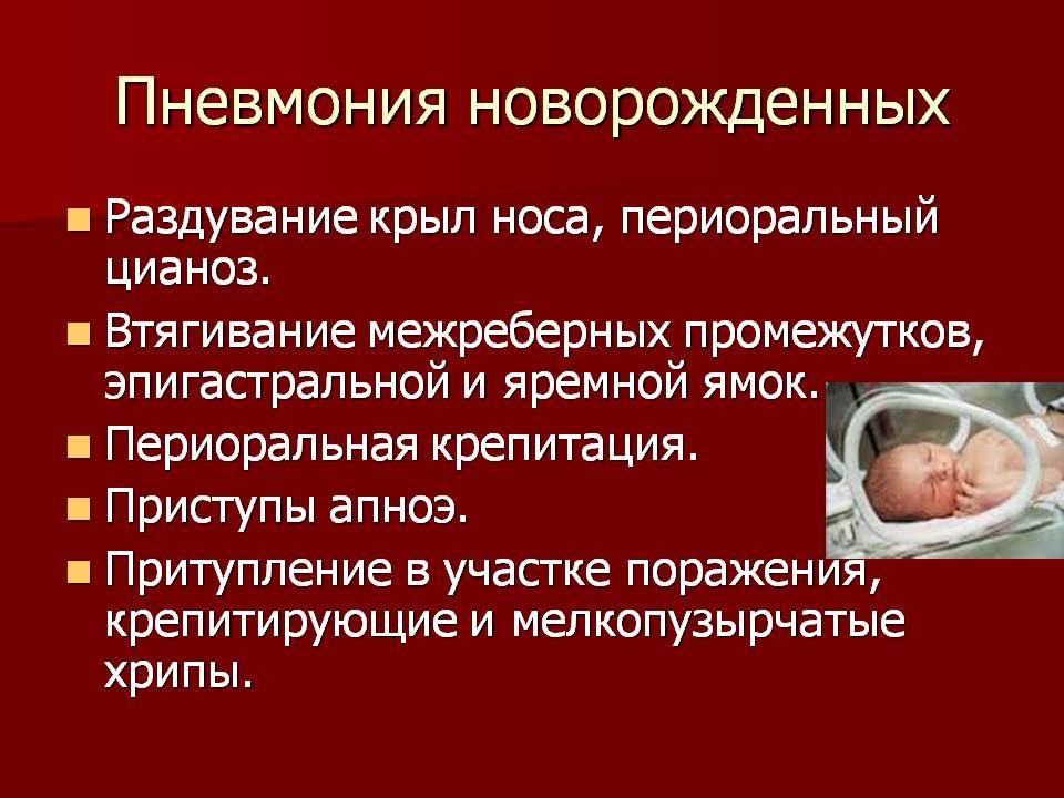 Пневмония симптомы у детей. Пневмония у новорожденных. Пневмония у новорожденного. Пневмония у новорожденных детей. Неонатальная пневмония новорожденных.