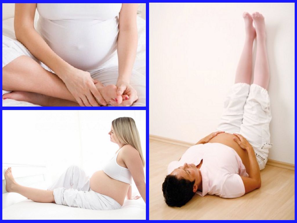 Отеки во время беременности. что делать? :: polismed.com
