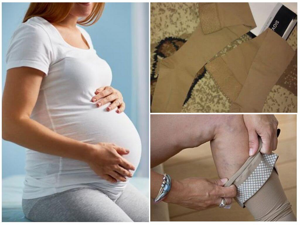 Можно ли пользоваться автозагаром во время беременности