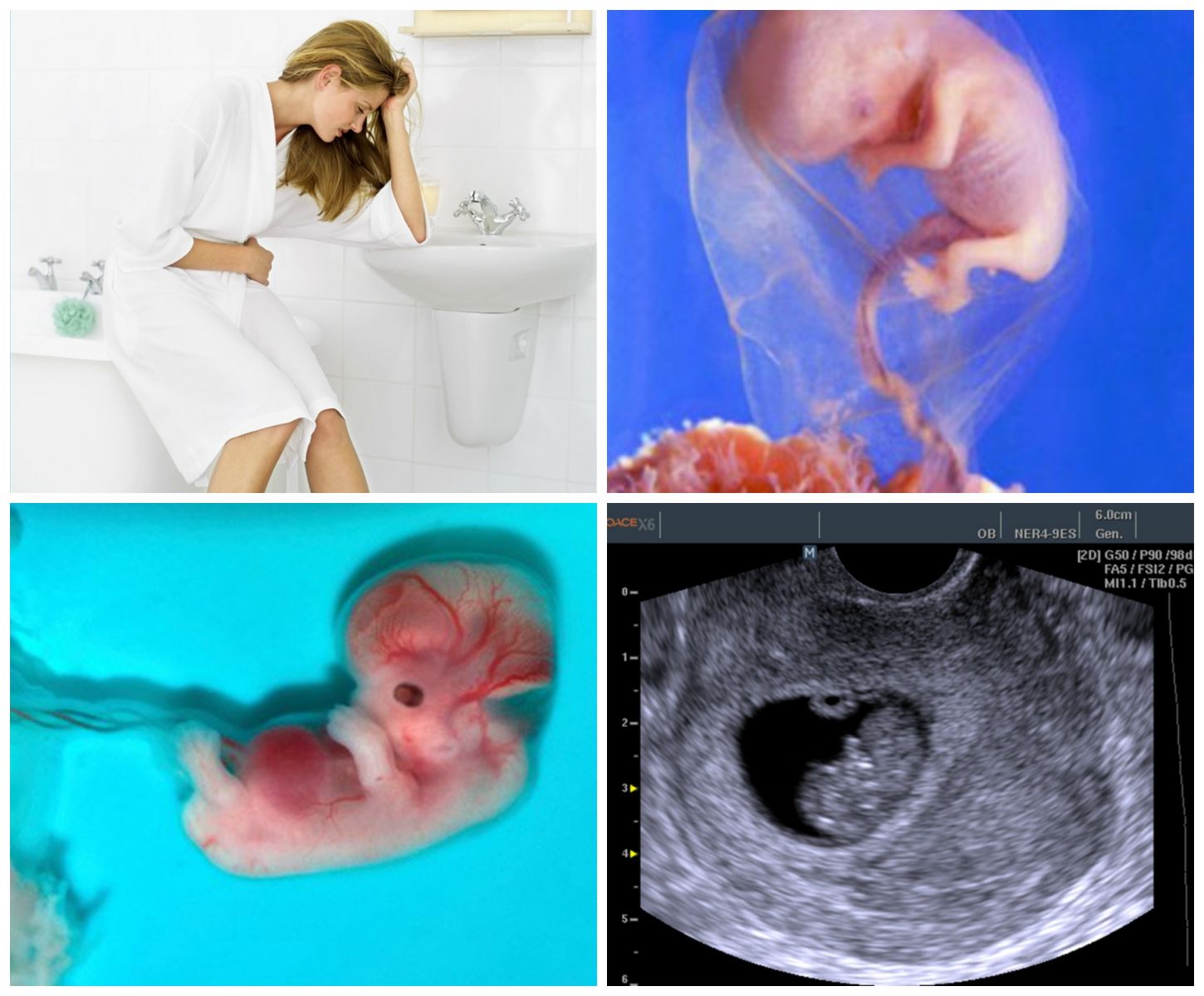 Развитие эмбриона и плода - восьмая неделя беременности | аборт в спб