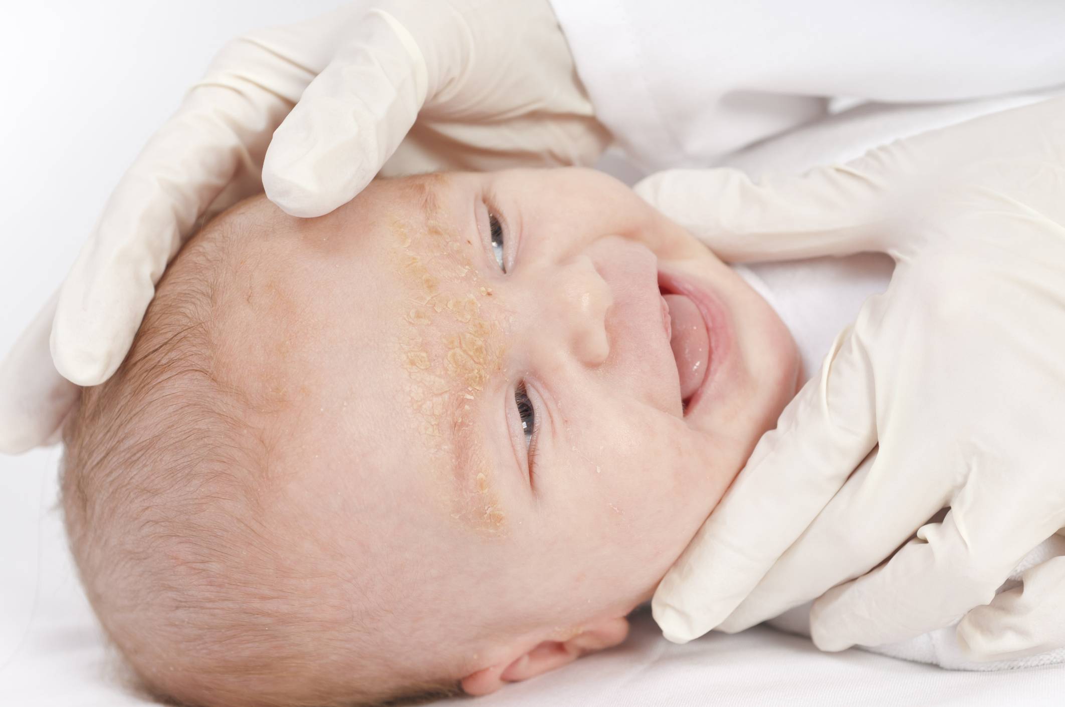 У малыша поднялась температура: как себя вести родителям | университетская клиника
