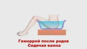 Послеродовое восстановление фигуры и психики