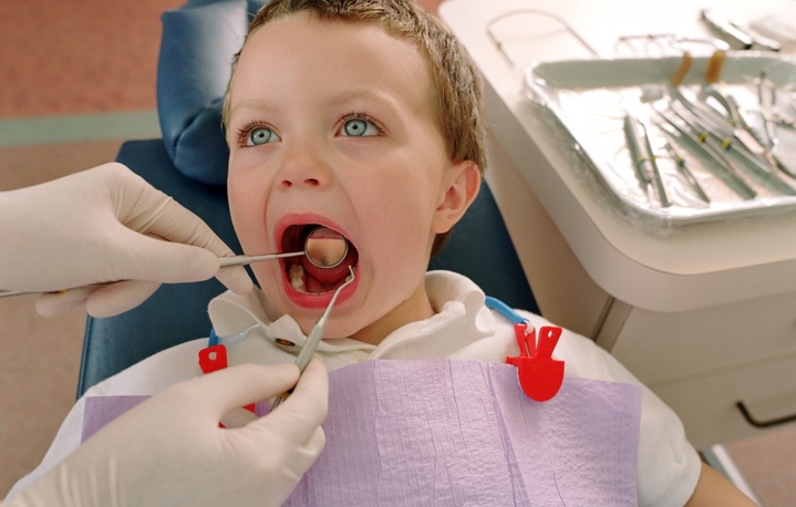 Подрезание короткой уздечки верхней губы у детей: зачем подрезают и нужно ли