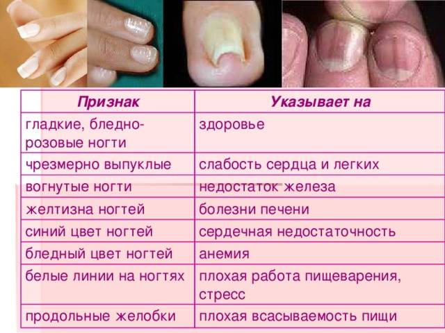 Можно ли красить ногти (лаком, гель лаком, шеллаком) во время беременности