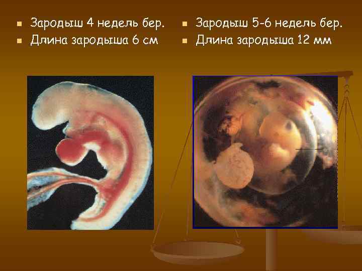 5 неделя беременности: фото плода, что происходит, выделения, признаки, узи