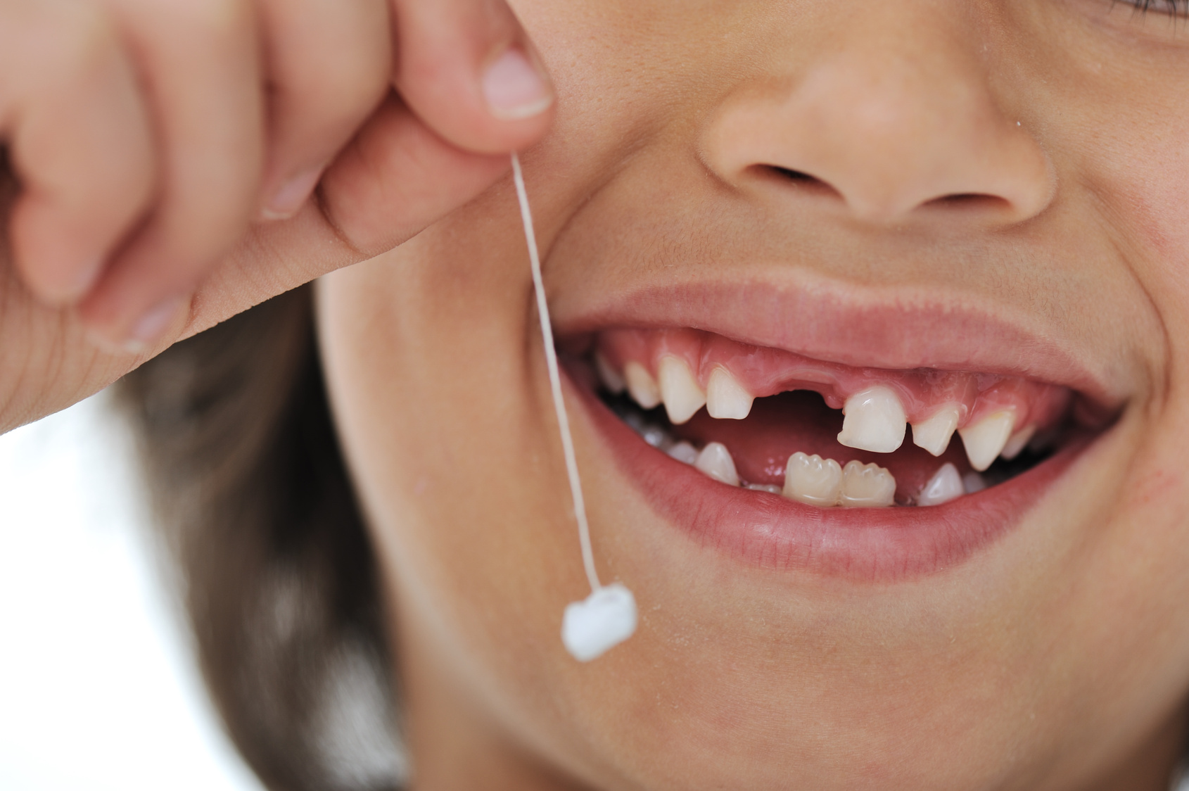 Молочные зубы у детей: схема прорезывания и выпадения, уход за полостью рта