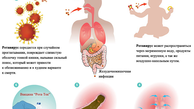 Симптомы ротавируса у детей. Ротавирус у детей. Ротавирусная инфекция боль в животе. Ротавирус симптомы у детей.