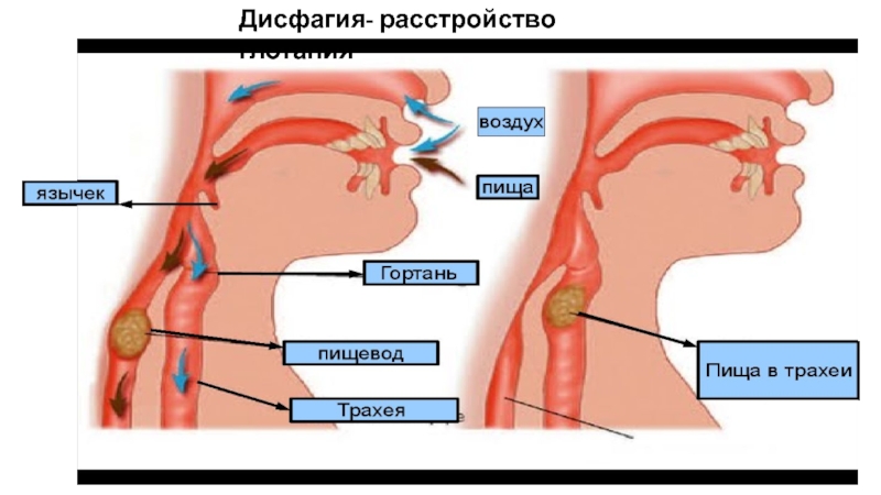 Избирательность в еде у детей. взгляд нейропсихолога. причины и пути помощи.