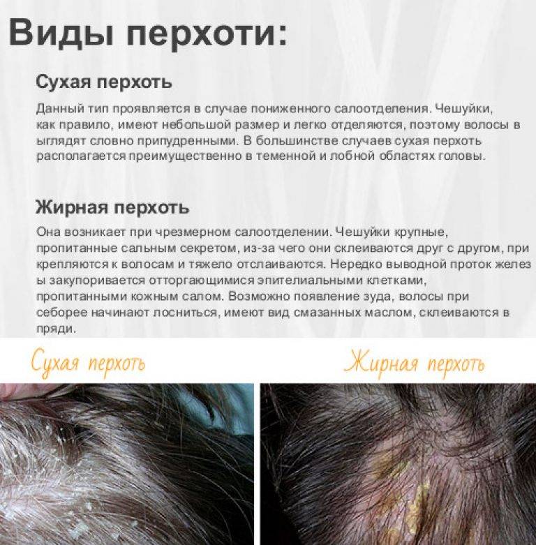 Выпадают волосы при беременности — беременность. беременность по неделям.