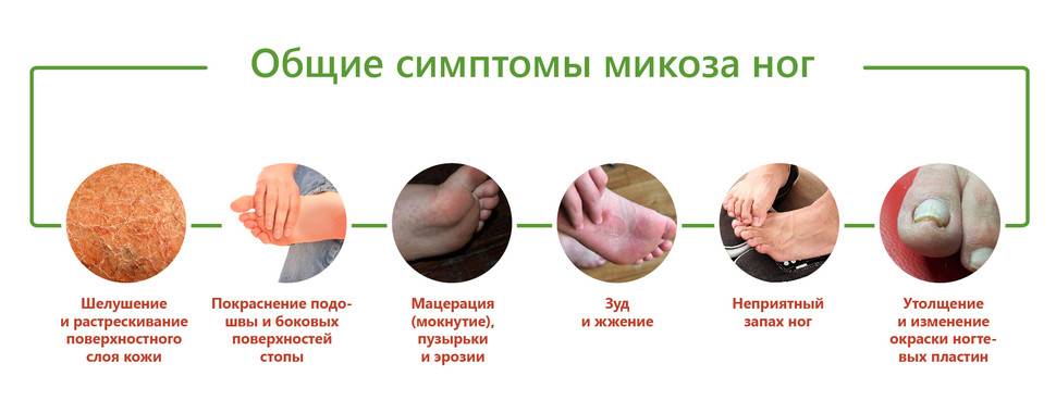 Цистит у детей - симптомы, диагностика и лечение у ребенка | детская урология см-клиники в санкт-петербурге