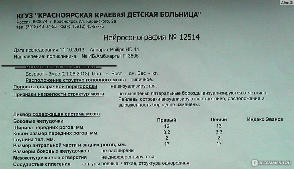 6 показаний для проведения нейросонографии головного мозга новорожденных