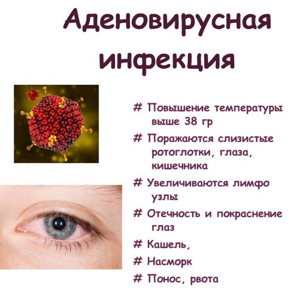 Аденовирус (аденовирусная инфекция) – симптомы, диагностика и лечение :: polismed.com