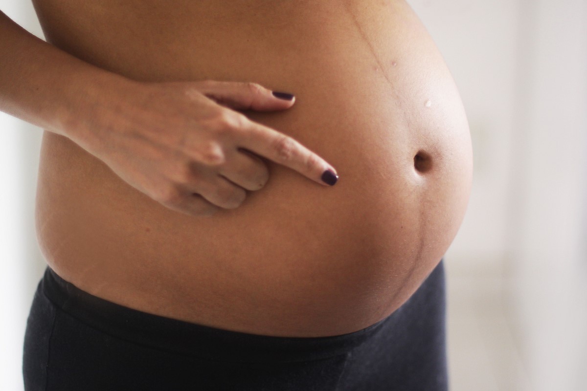 Эпиляция и беременность - какой метод эпиляции выбрать?