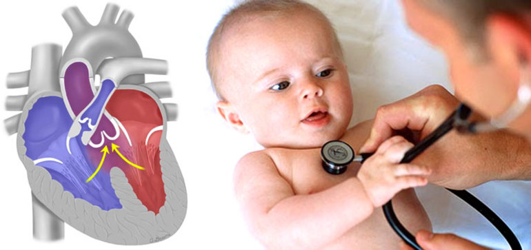 Топ-5 признаков, что нужно обращаться к детскому кардиологу