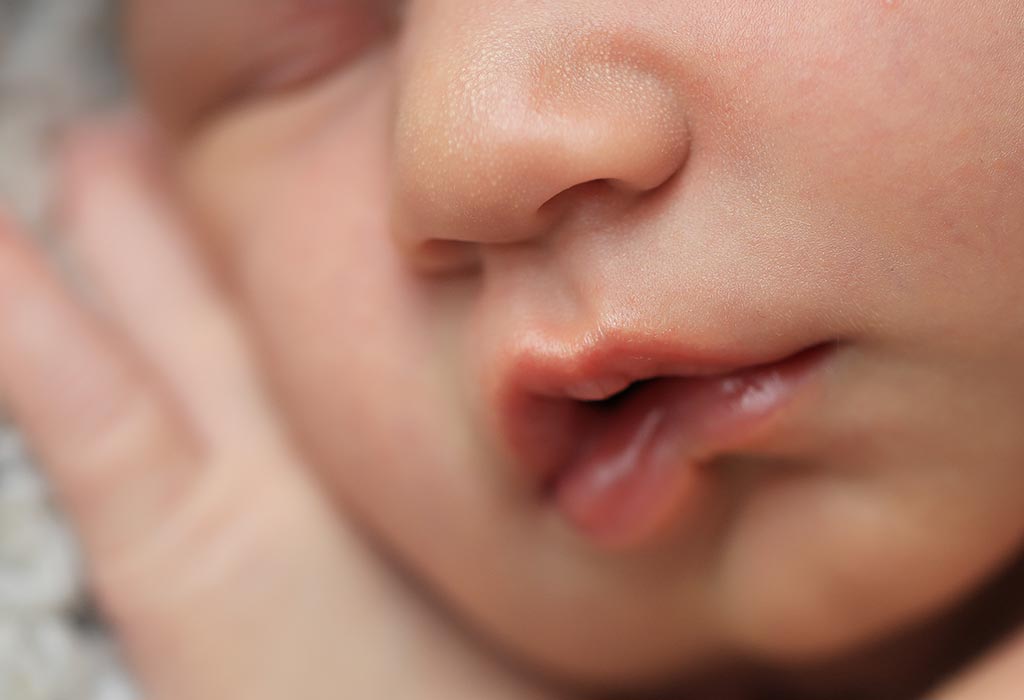 Мозоль на губе у новорожденного, грудничка: причины и лечение