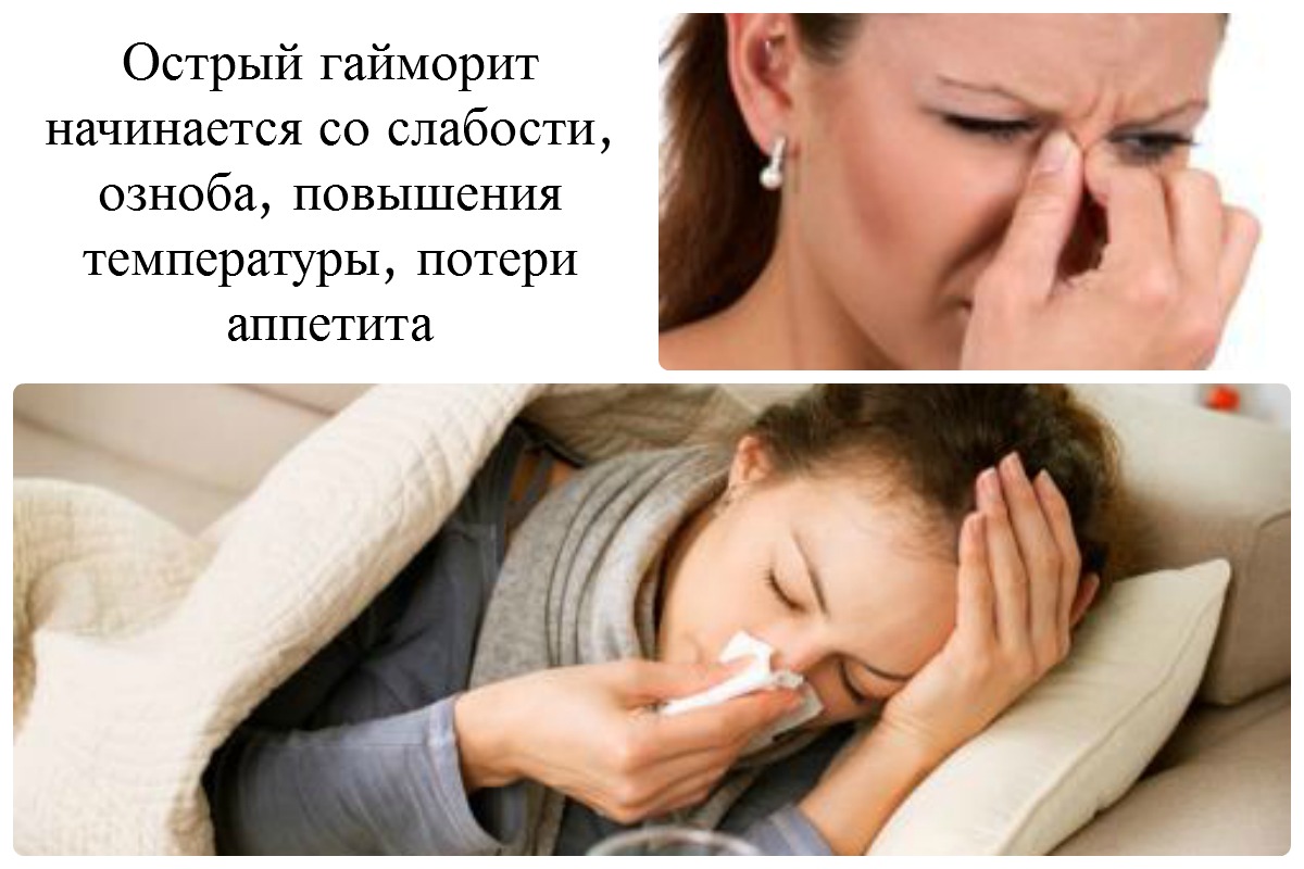 Острая головная боль температура заложенность носа