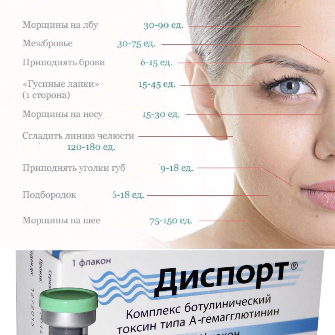 Ботулотоксин и беременность: как быть врачу и пациенту | портал 1nep.ru
