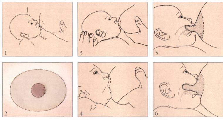 Ребенок кусает грудь во время кормления: что делать, отзывы