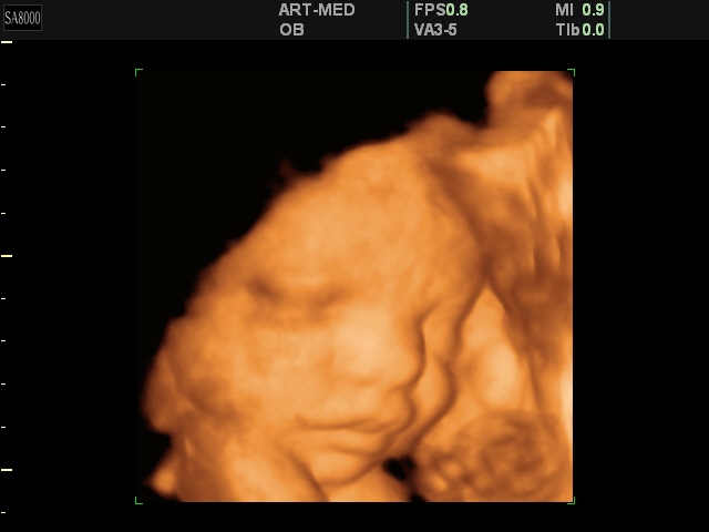 Ребенок на 33 неделе беременности фото