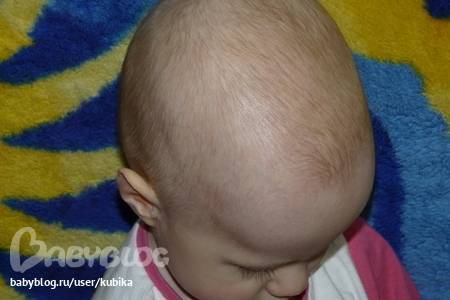 Плохо растут волосы у грудничка 8 месяцев. почему у ребёнка не растут волосы