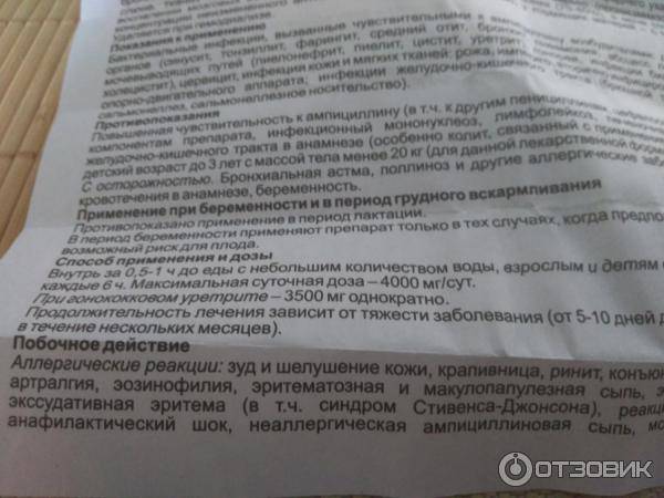 Тонзиллит: симптомы, лечение у детей, взрослых, беременных