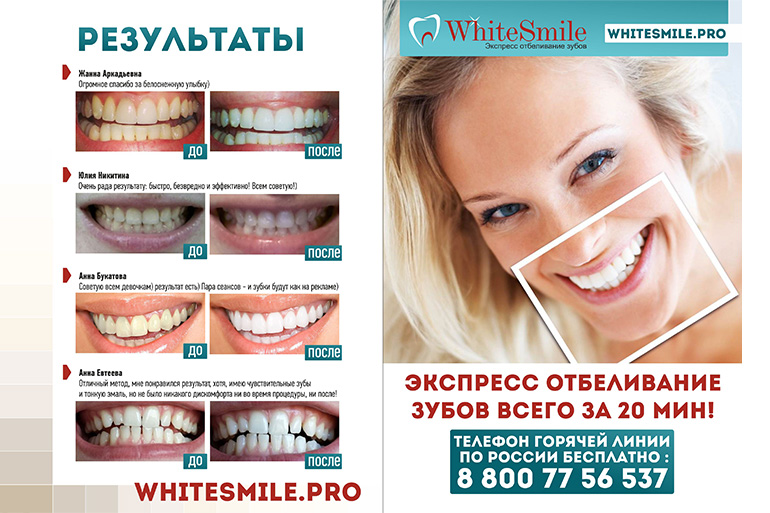 Чистка зубов казань акции. Отбеливание зубов. Отбеливание зубов White smile. Косметическое отбеливание зубов реклама. Стоматология после до реклама.