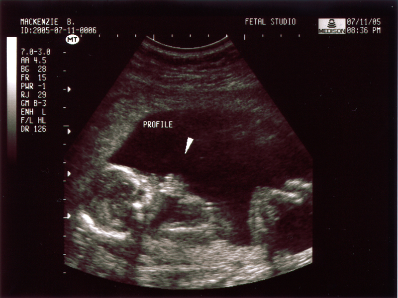 15 неделя беременности: что происходит, ощущения в животе, размер плода, фото