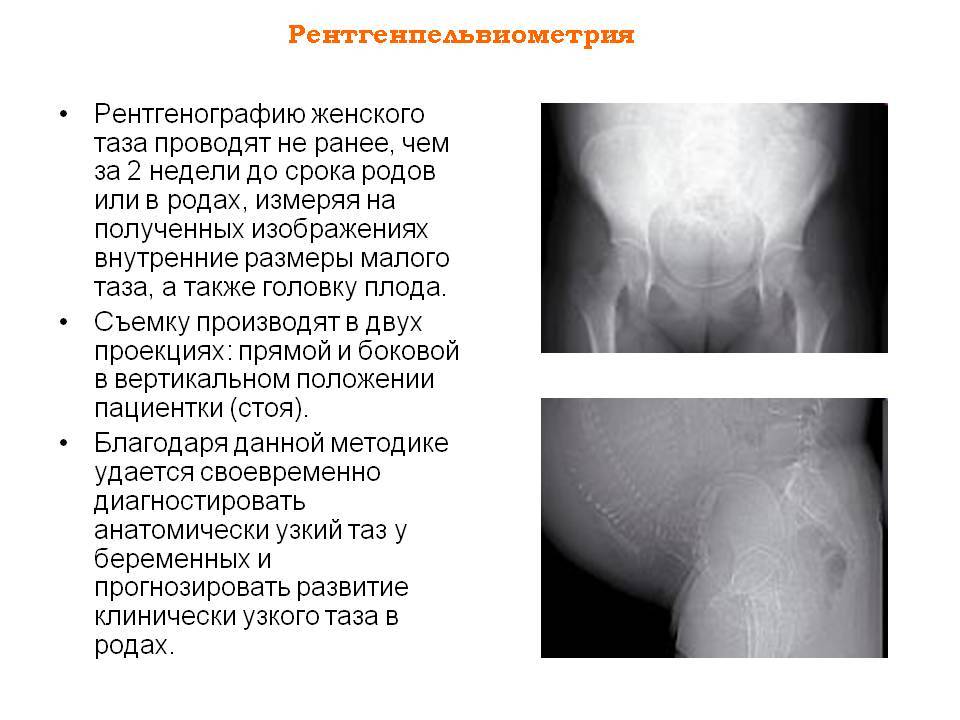 Можно ли совершать перелеты во время беременности?