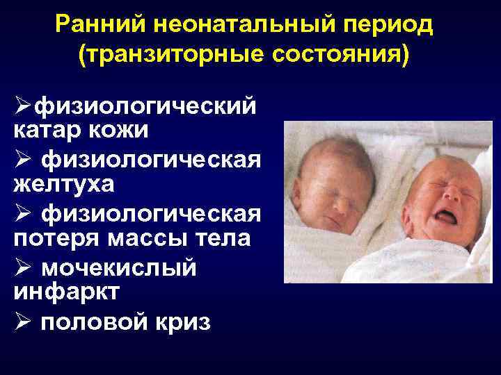 17 особенностей новорождённого ребёнка в неонатальный период