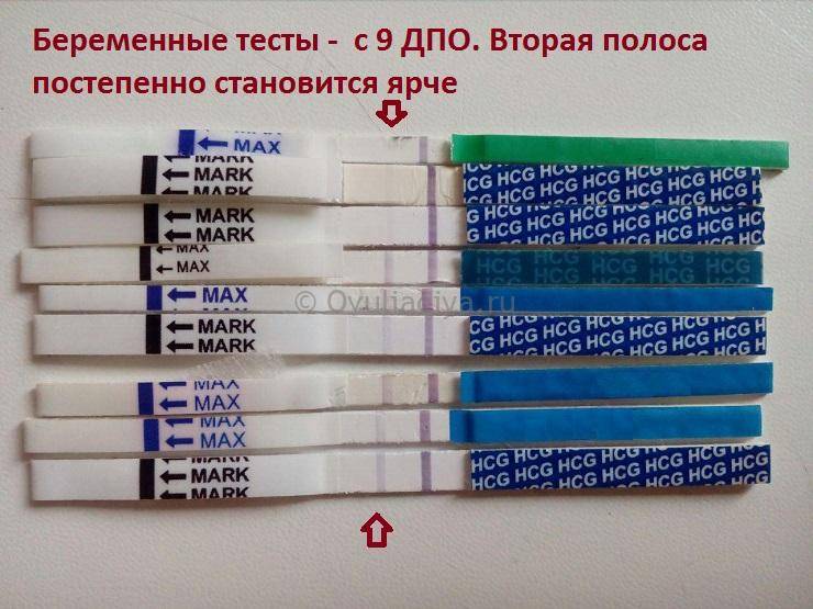 Ложная беременность (псевдобеременность, псевдоциез): диагностика и лечение