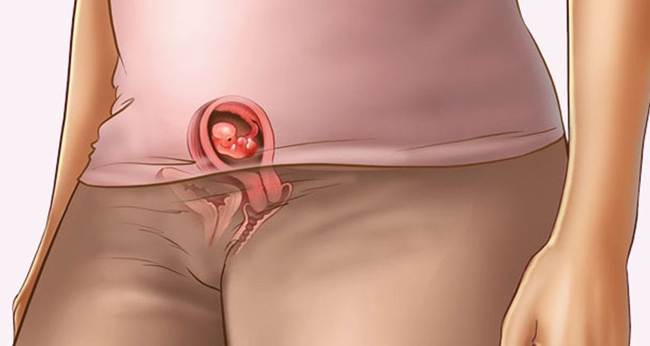 Se puede comer lentejas en el embarazo