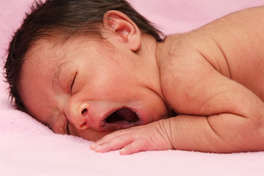 «укус аиста» и «поцелуй ангела»: «родовые пятна» у новорожденных - ecocenter.by