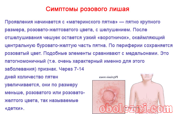 Стригущий лишай | симптомы | диагностика | лечение - docdoc.ru
