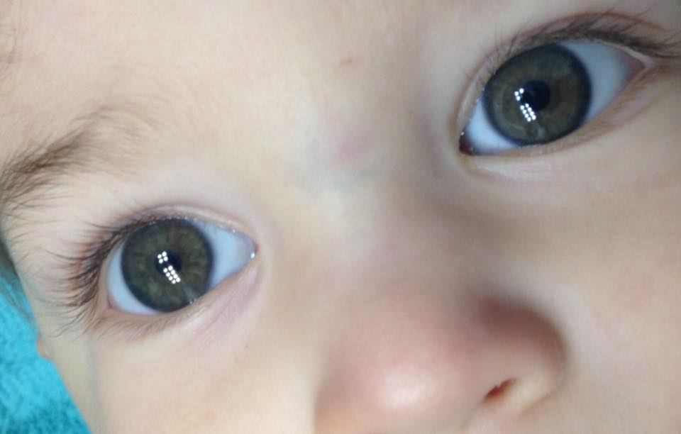 Закисание глаз, гнойные выделения у детей: симптомы, профилактика