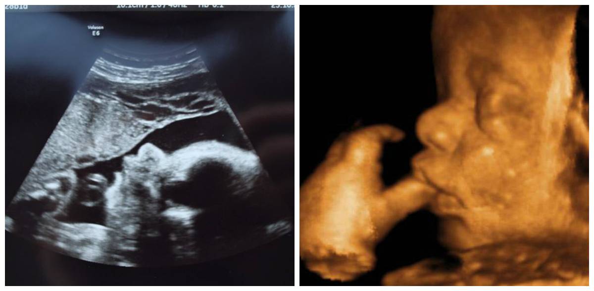 37 неделя беременности развитие и фото — евромедклиник 24