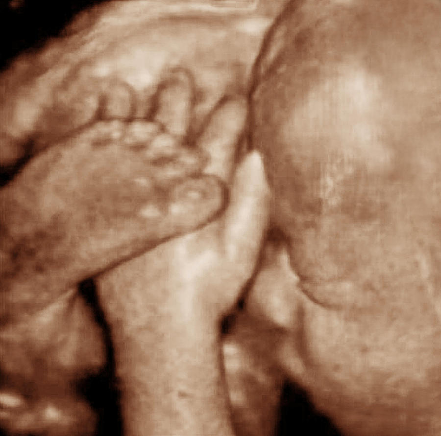 Протекание беременности на 32 неделе — состояние здоровья мамы и малыша | аборт в спб