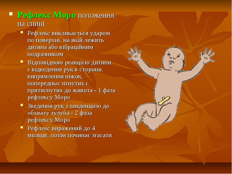 Эффект моро у младенцев до какого возраста - детская городская поликлиника №1 г. магнитогорска