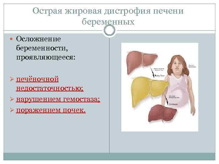 Можно ли есть острое при беременности? / mama66.ru