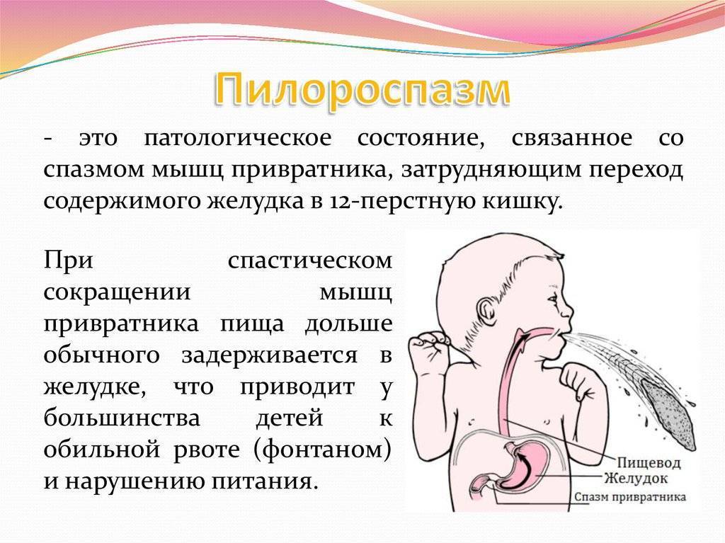 Синдром рвоты и срыгивания у новорожденных презентация