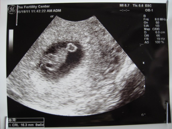 7 неделя беременности. календарь беременности   | материнство - беременность, роды, питание, воспитание
