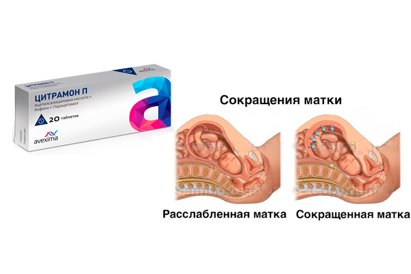 Тонус матки при беременности | уроки для мам