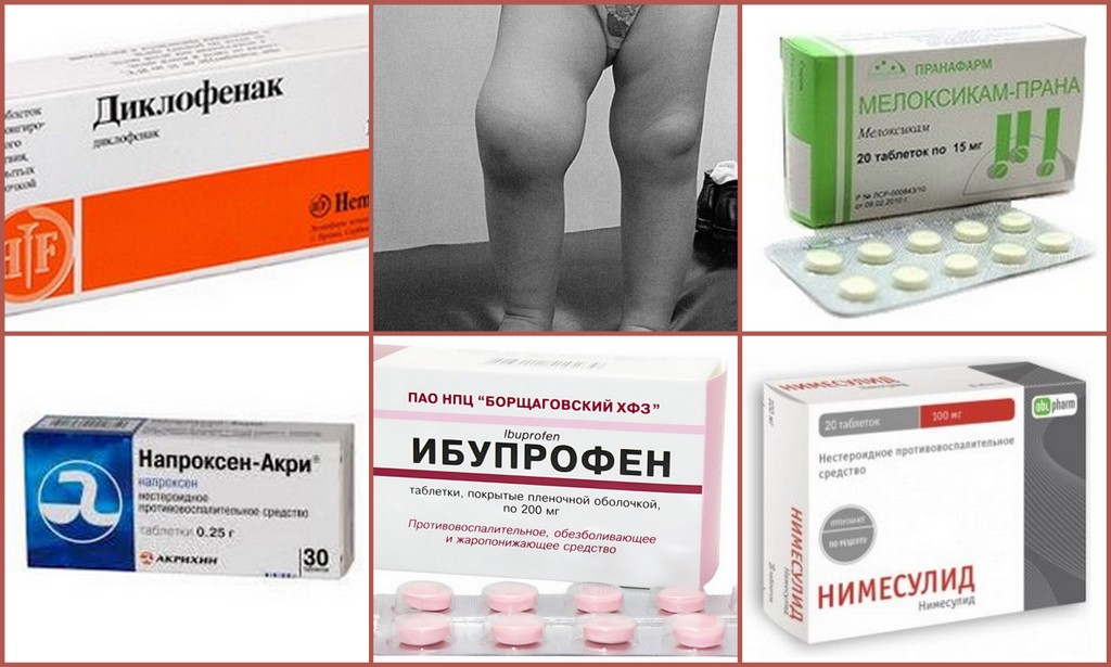 Ревматологическое обследование. анализ крови на уровень мочевой кислоты, ревматоидный фактор и пр.