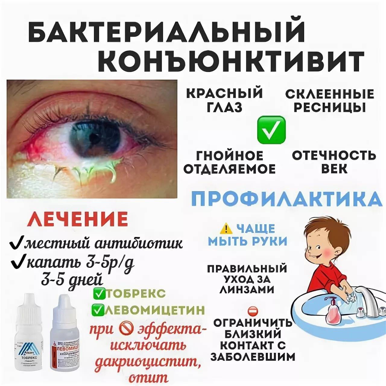 Левомицетин капли глазные для детей и новорожденных - инструкция, отзывы