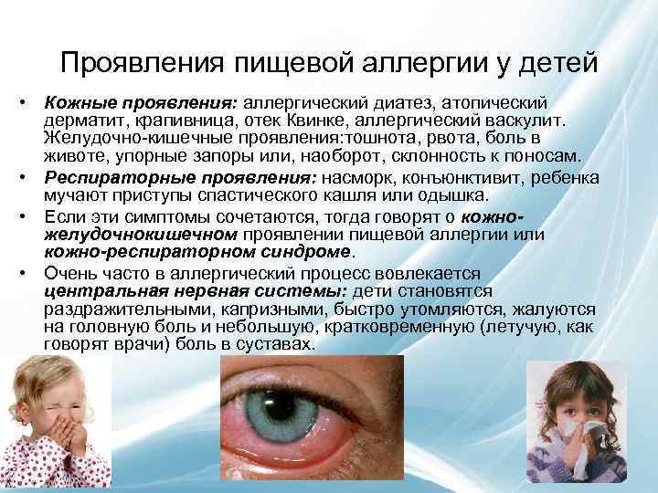 Аллергический диатез у детей - симптомы болезни, профилактика и лечение аллергического диатеза у детей, причины заболевания и его диагностика на eurolab