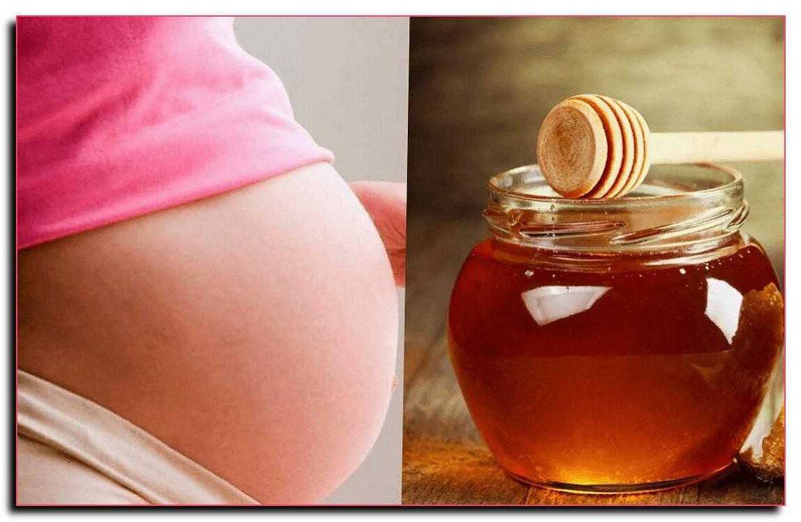 Можно ли мед беременным – 1, 2, 3 триместр, с чаем, редька с медом, на ранних сроках