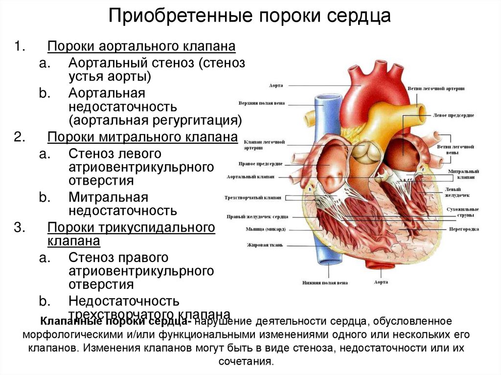 Врожденные пороки сердца у детей — медицинский центр «целитель»