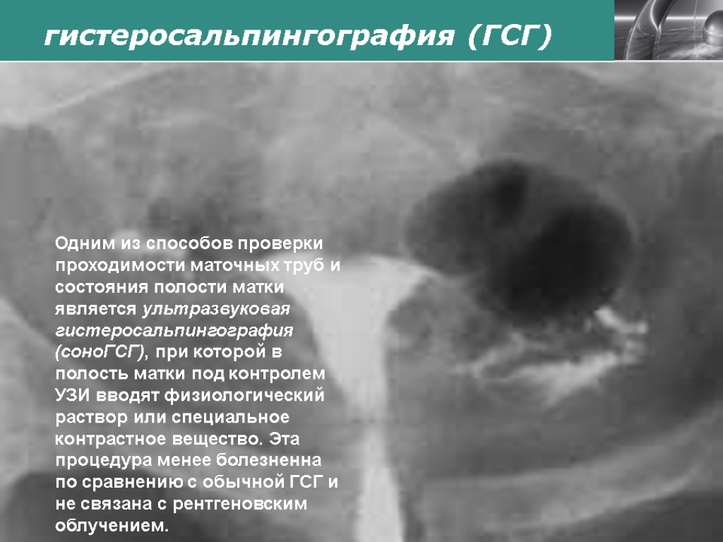 Рентген при беременности. можно ли делать рентген при беременности. рентген зуба при беременности — беременность. беременность по неделям.
