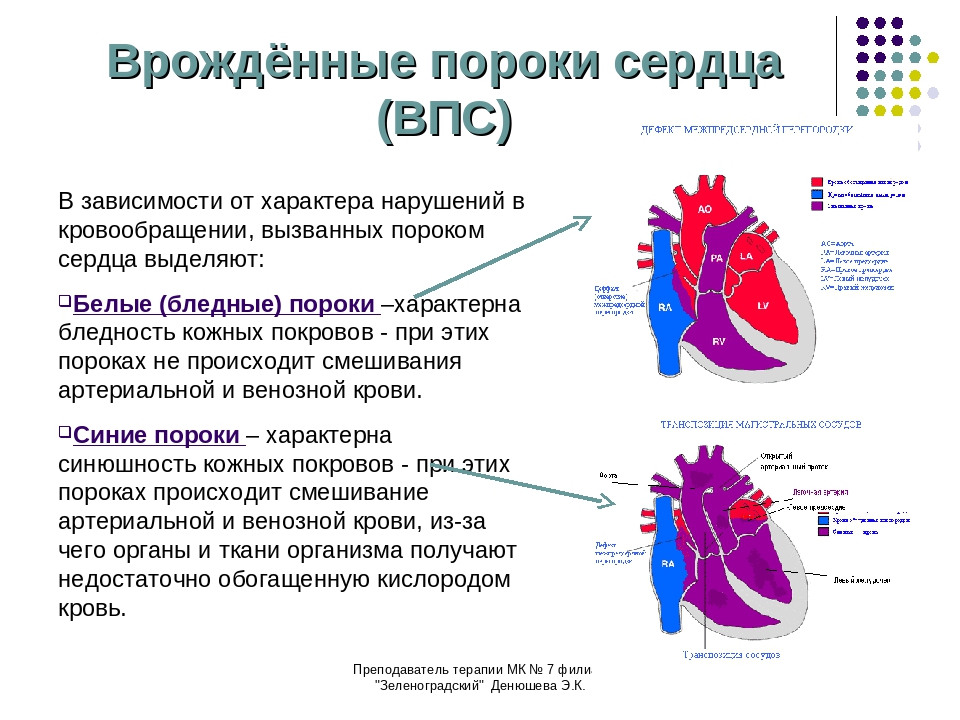 Причины, симптоматика и методы лечения при врождённом пороке сердца – двухстворчатом аортальном клапане