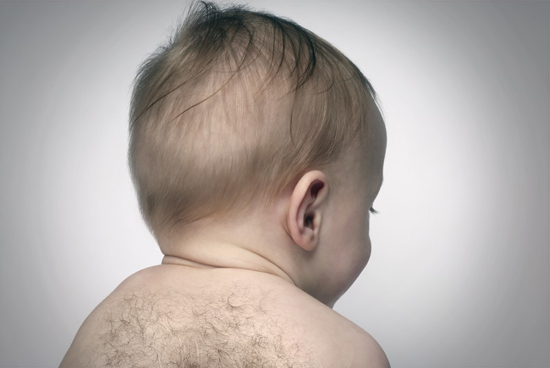 Нормально ли появление волос на ушах и спине у новорожденных?